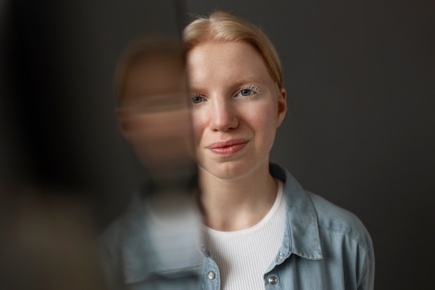 Vista frontal mulher albina posando