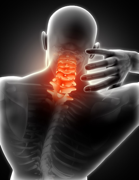 3D übertragen von einem medizinischen Bild machen einen Mann mit Nackenschmerzen zeigen