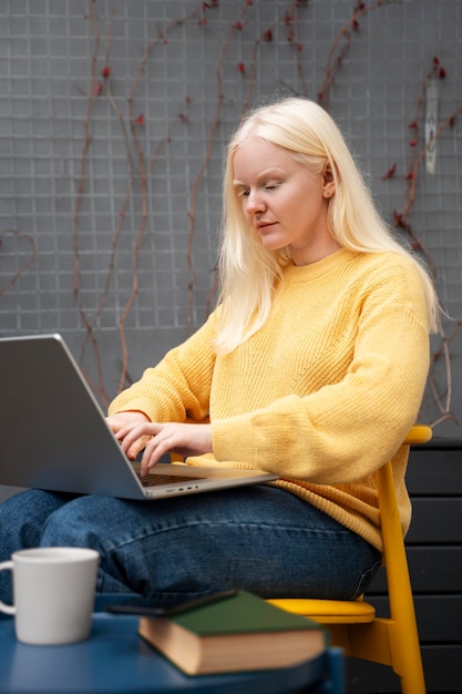 Albino-Frau mit mittlerem Schuss, die mit Laptop arbeitet