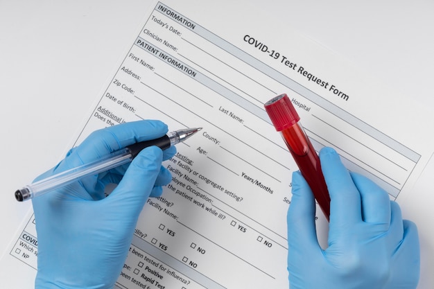 Anordnung der Coronavirus-Blutproben im Labor