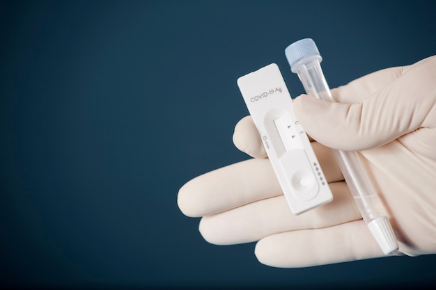 Arzt, der ein covid-19-antigen-testkit mit einem covid-19 2019-ncov-testkit für viruserkrankungen besitzt. test des sars-cov-2-coronavirus-virus-laborkarten-kits. schneller covid-19-test
