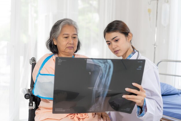 Arzt Informieren Sie die Ergebnisse der Gesundheitsuntersuchung des Röntgenfilms, um ältere ältere Frauen zu ermutigen. Patienten mit gebrochenem Arm im krankenhausmedizinischen Seniorenkonzept