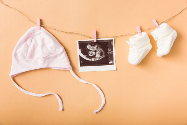 Baby Mütze; Ultraschallbild und Paar woolen Schuhe, die an der Wäscheleine gegen einen orange Hintergrund hängen