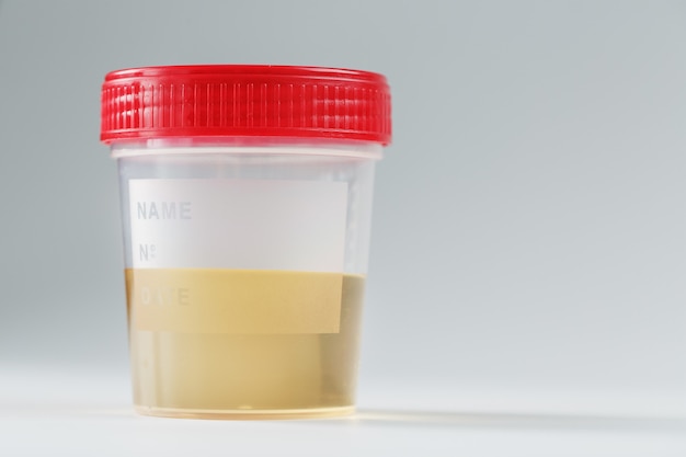 Behälter mit medizinischen urintests