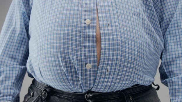 Übergewichtiger Mann in kurzen Hosen ist für ihn klein mit riesigem Bauch und offenen Knöpfen