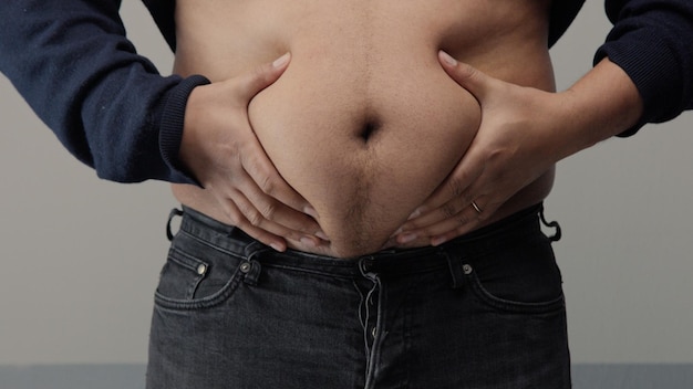 Übergewichtiger Mann Nahaufnahme der Vorderansicht des Bauches Hemd aufstellen und einen Bauch kneifen und klatschen