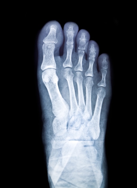 Chirurgie Radius Technologie x-ray Röntgenstrahl