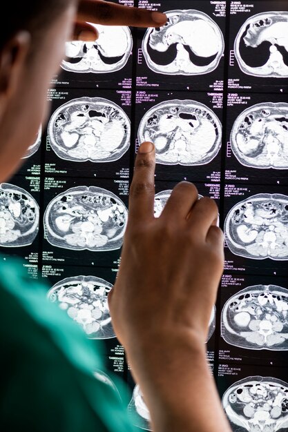Doktor, der Gehirn MRI-Röntgenstrahlresultat liest
