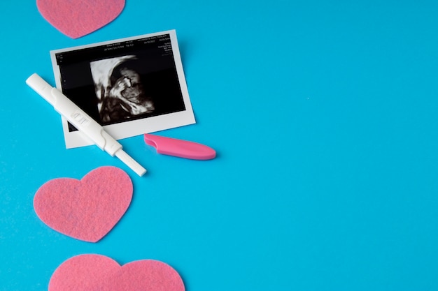 Kostenloses Foto draufsichthand, die schwangerschaftstest hält