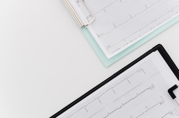 Eine Draufsicht des medizinischen EKG-Berichts über blaues und schwarzes Klemmbrett auf weißem Hintergrund