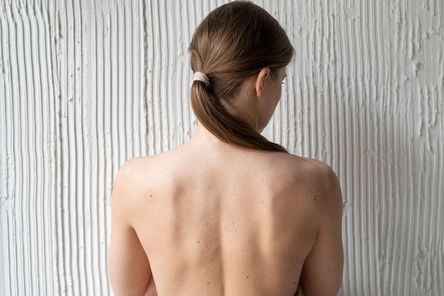 Kostenloses Foto frau mit melanom auf ihrer haut