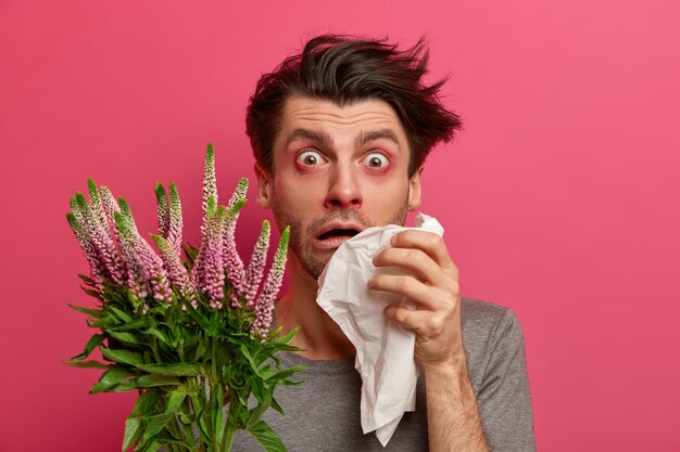 Frustrierter ungesunder Mann leidet an einer allergischen Störung, die Augen fangen an zu tränen, hat eine laufende Nase, hält ein Taschentuch und sieht verzweifelt aus, empfindlich gegenüber saisonalen Allergenen hat Kurzatmigkeit