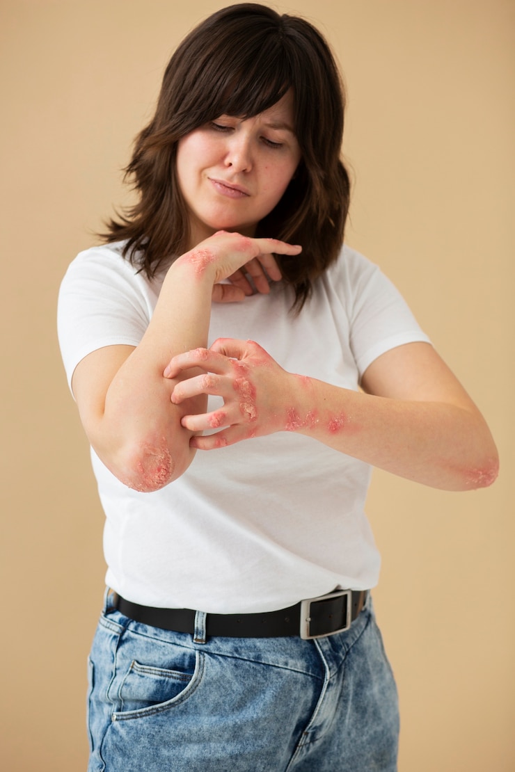 Kostenlose Foto hände eines patienten, der an psoriasis leidet