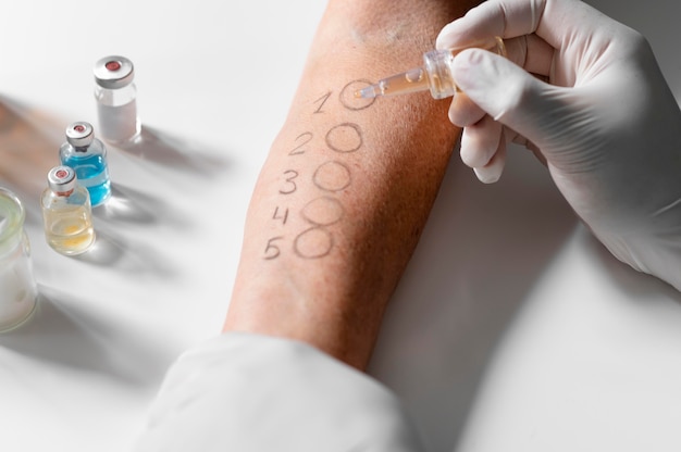 Hautallergie-Reaktionstest am Arm
