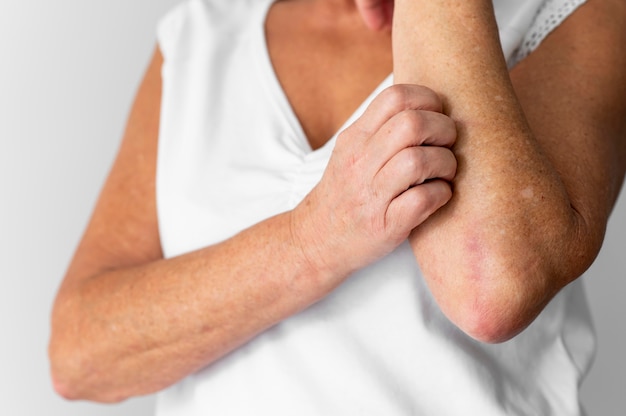 Hautallergie-Reaktionstest am Arm