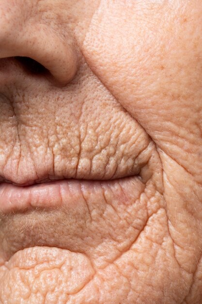 Hautbeschaffenheit der älteren Frau der Vorderansicht