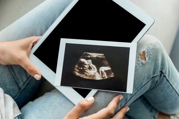 Junge Frau mit Ökographie und Tablette