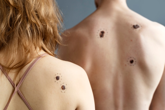 Kostenloses Foto junge menschen mit melanom-rückansicht