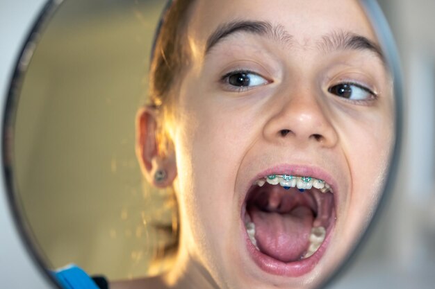 Kostenloses Foto kaukasisches jugendliches mädchen mit zahnspange, das in den spiegel schaut