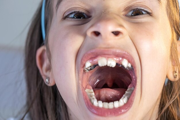 Kind während des Zahnorthopädie-Besuchs und der Mundhöhle-Untersuchung