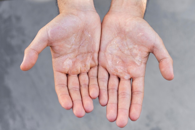 Kostenloses Foto mann mit hydroalkoholischem gel