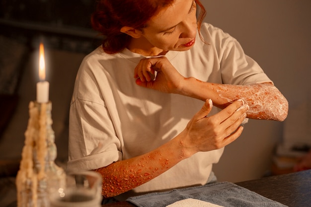 Kostenloses Foto mittelgroße frau mit hautkrankheit