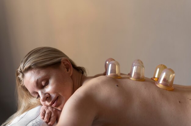 Mittlere Schussfrau, die Schröpfen Therapie erfährt