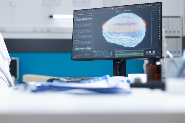 Modernes, leeres Krankenhausbüro mit Computer mit MRI-Gehirndiagaram auf dem Bildschirm, der für die Onkologieuntersuchung bereit ist. Kabinett mit medizinischen professionellen Werkzeugen ausgestattet. Bild der Hirntomographie