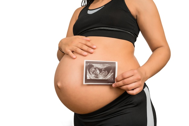 Nahaufnahme der schwangeren Frau, die das Bild des Ultraschallscans des Babys hält