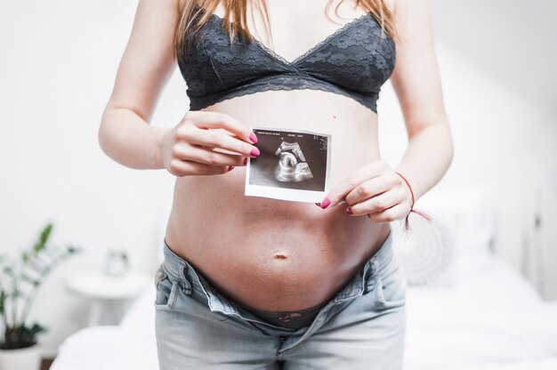 Nahaufnahme einer schwangeren Frau, die Ultraschallfoto vor ihrem Bauch hält