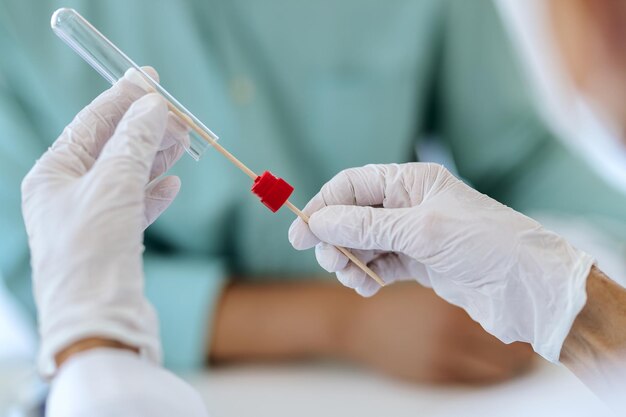 Nahaufnahme eines Arztes, der während der COVID19-Pandemie einen PCR-Test durchführt