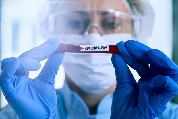 Nahaufnahme eines Epidemiologen, der eine COVID19-Blutprobe hält