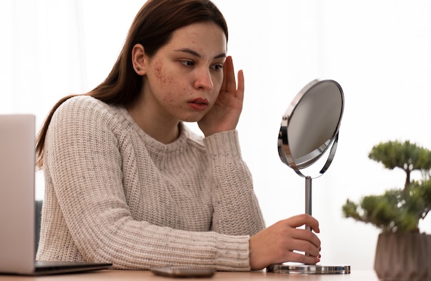 Kostenloses Foto person, die mit rosacea zu tun hat