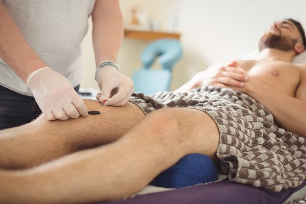 Physiotherapeut, der eine Trockennadelung am Knie eines Patienten durchführt