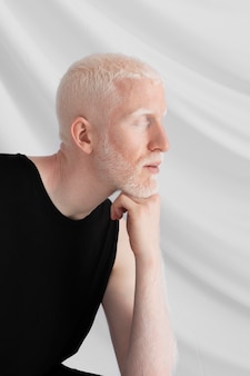 Schöner albino-mann posiert