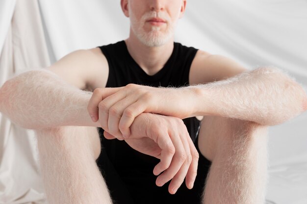 Schöner Albino-Mann posiert
