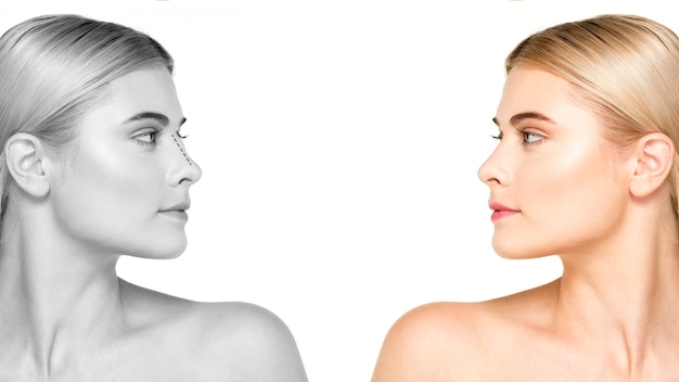 Kostenloses Foto seitenansichtfrau vor und nach rhinoplastik