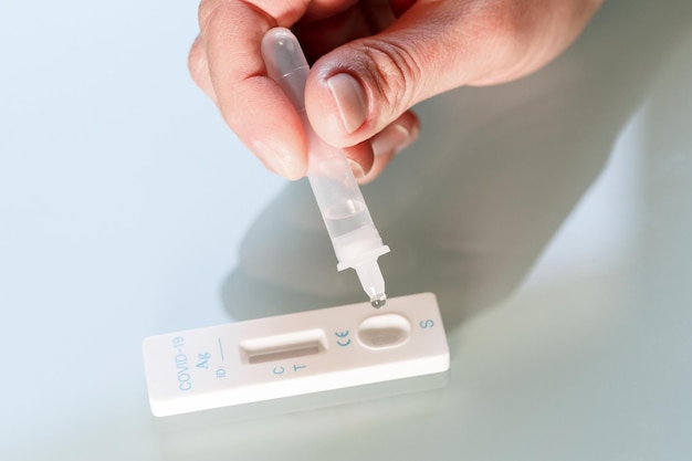 Tropfen eines testmaterials in eine schnelltestkassette für den covid-19-antigentest. medizinisches versorgungskonzept