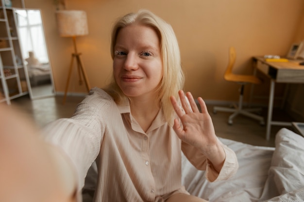 Kostenloses Foto vorderansicht albino-frau posiert