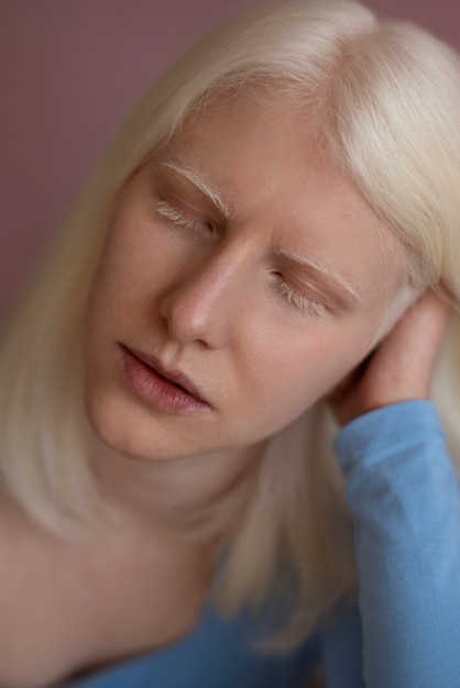 Kostenloses Foto vorderansicht einer frau mit albinismus, die im studio posiert