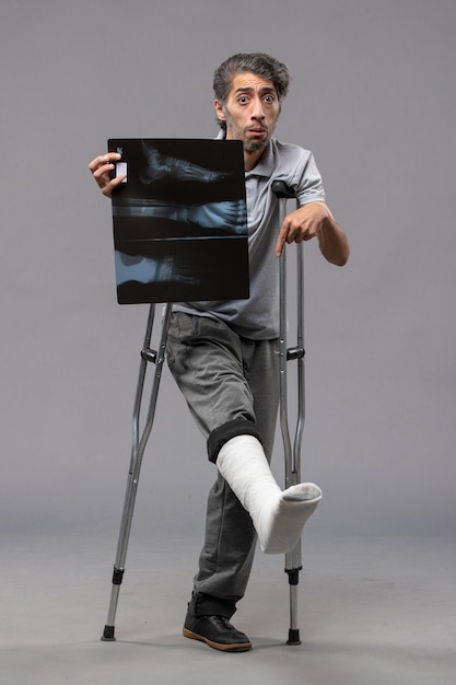 Kostenloses Foto vorderansicht junger mann mit gebrochenem fuß, der krücken verwendet und sein röntgenbild an der grauen wand hält, deaktivieren unfallfußverdrehung gebrochene schmerzen
