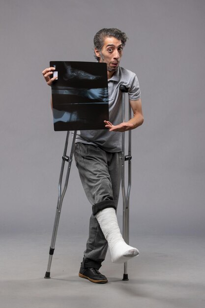 Vorderansicht junger Mann mit gebrochenem Fuß, der Krücken verwendet und sein Röntgenbild auf grauer Wand hält, deaktiviert gebrochene Unfallschmerz-Fußdrehung