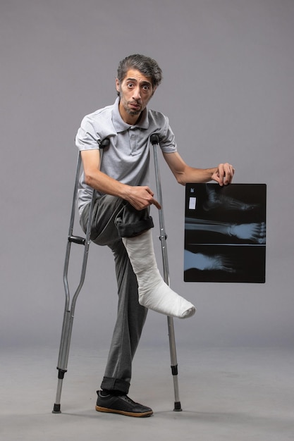 Vorderansicht junger Mann mit gebrochenem Fuß, der Krücken verwendet und seine Röntgenaufnahme auf grauem Schreibtischschmerz hält, deaktiviert den Beinbruch des Unfallfußes