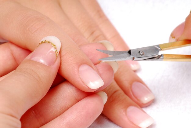 Zeigefinger - Nagelhaut geschnitten