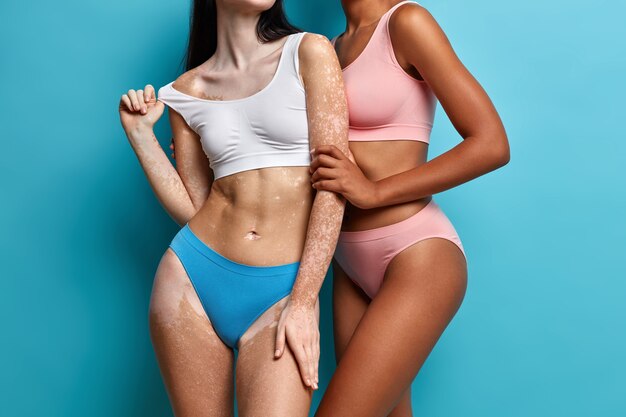 Zwei Frauen mit unterschiedlichem Hautzustand umarmen sich