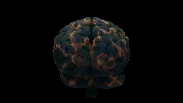 3D-Darstellung des Gehirns mit Schadenszonen. Infektion oder ein anderer Grund für das Konzept der Hirnschädigung. Isolierte Abbildung.