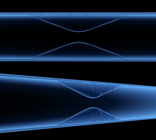 3D-Rendering-Röntgen-Arteriosklerose mit Cholesterin-Blut oder Plaque in Gefäßen, die eine koronare Herzkrankheit verursachen