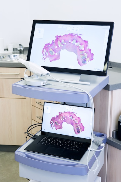 3D-Zahnscans auf Computer und Laptop in der Zahnarztpraxis