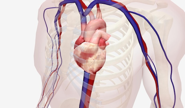 Foto a colocação do registrador de loop implantável