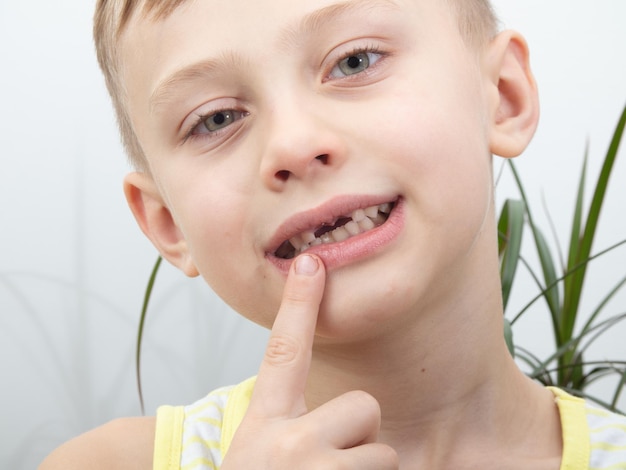 A criança aponta o dedo para o buraco nos dentes depois de arrancar os dentes de leite.